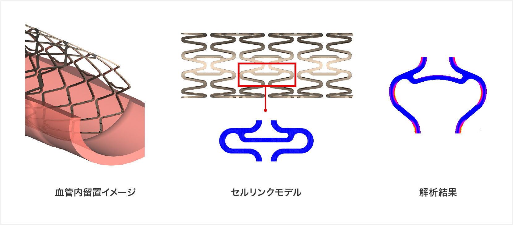 有限要素解析を使用したコンピュータ解析